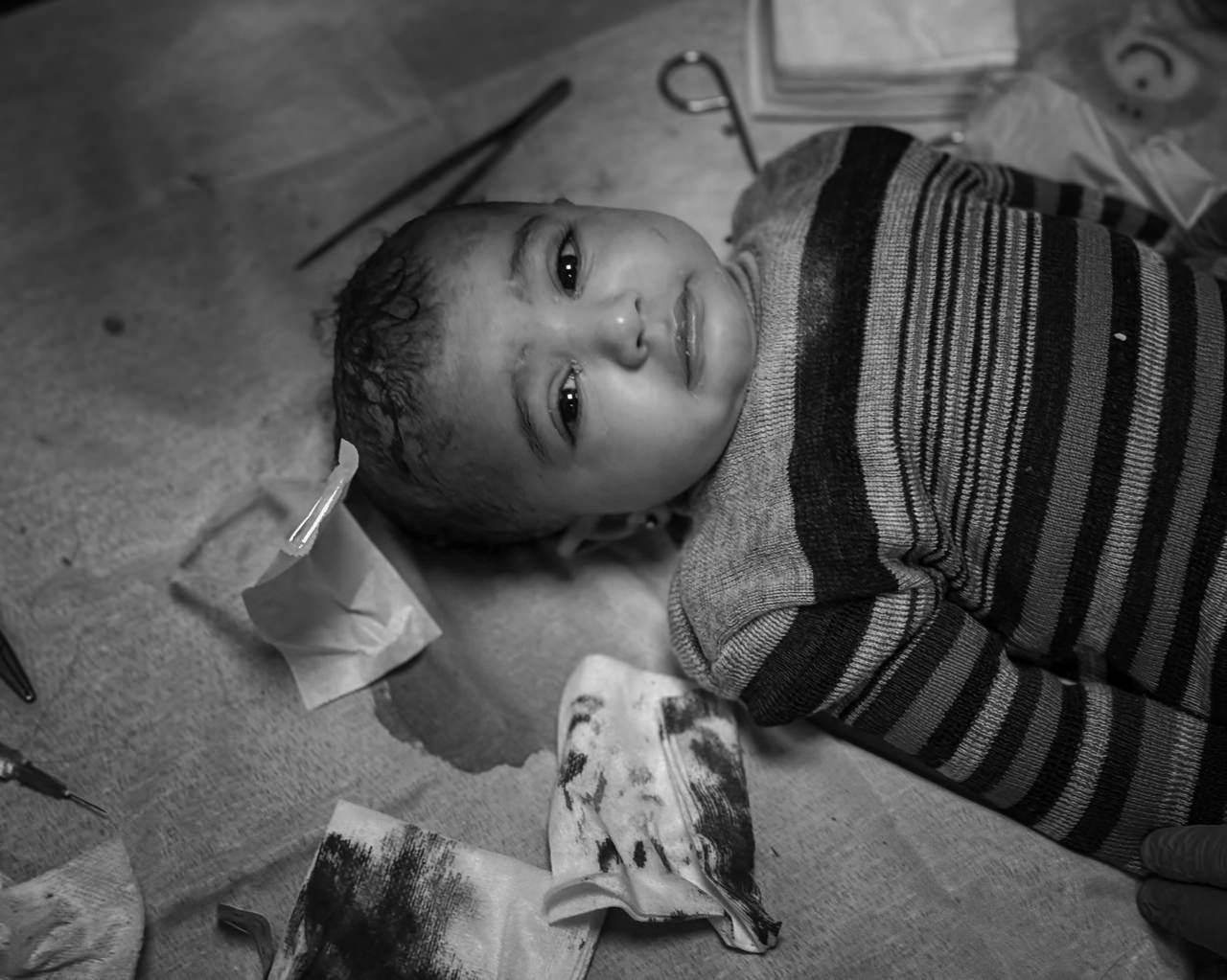 Gazze’deki 17 bin çocuğun ebeveynleri ya öldürüldü ya esir alındı