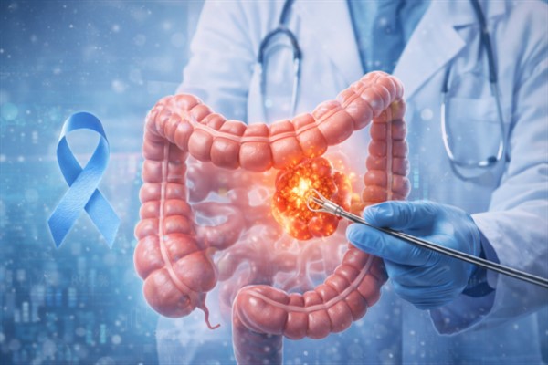 Kolon Kanseri Farkındalık Ayı’nda erken teşhis uyarısı