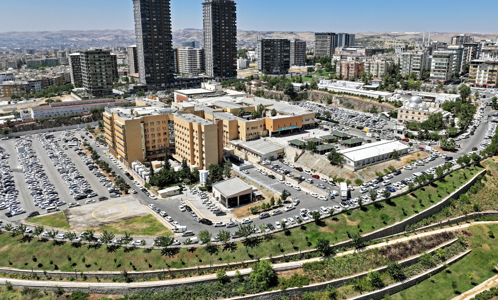Genç hastaya kalça protezini ertelemek için damarlı fibula grefti uygulandı